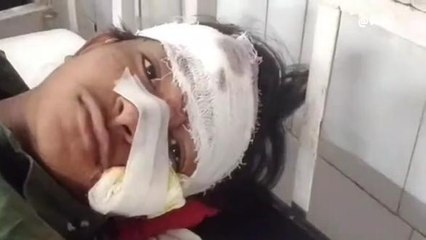 अटेर: लापरवाही से बाइक चलाना युवक को पड़ा भारी हुआ हादसा