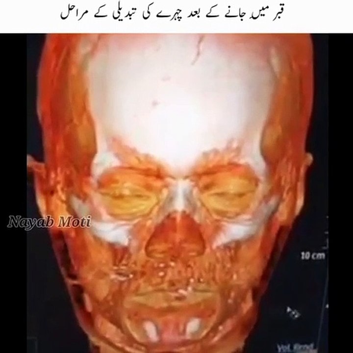 merny k bad Insane ka chehra kasy bdalta ha