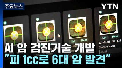 피 1cc로 6대 암 한꺼번에 발견하는 AI 검진법 / YTN