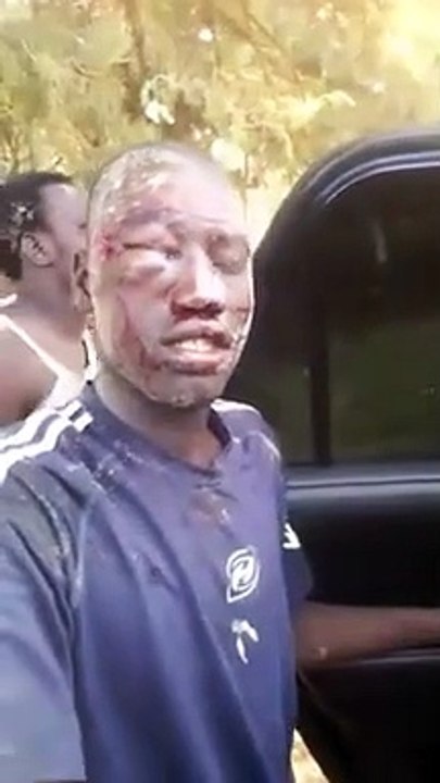 Photos-Video: Affrontements entre pêcheurs de Cayar et Mboro: Plusieurs blessés enregistrés