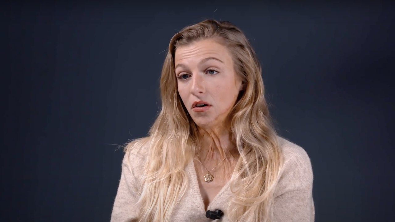 Julie Bourges, grande brûlée : "Ma jambe droite a commencé à s’enflammer et je suis vraiment devenue littéralement prisonnière des flammes"