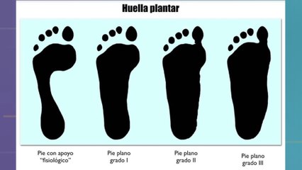 bd-pie-plano-y-su-impacto-en-la-vida-adulta-030423