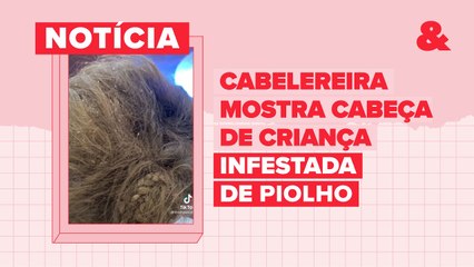 Cabeleireira revela a assustadora infestação de piolhos em criança 😱