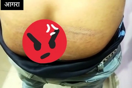 पति को पुलिस ने पकड़ा तो पत्नी ने खाया जहर