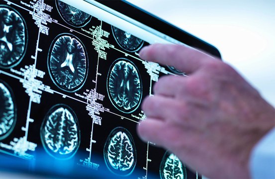 New cancer treatment technology could 'revolutionise treatment of brain tumours'