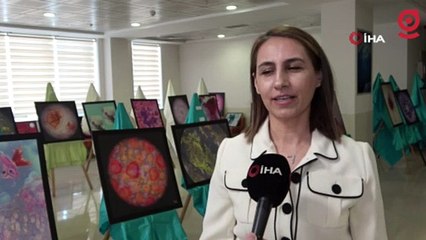 Hastalıklı dokular sanat eserine dönüştü