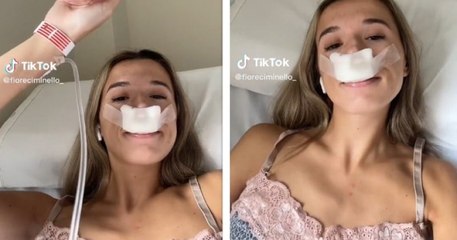 Une influenceuse subit une rhinoplastie pour que ses enfants aient le même nez qu'elle