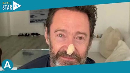 Hugh Jackman apparaît avec un pansement sur le nez, il lance un message important à ses fans