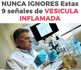 Nunca Ignores Estas 9 Señales de Vesicula Inflamada