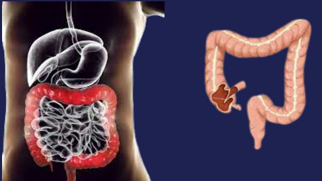 Health Nest /constipation?constipation causes treatment?قبض کیوں ھوتی ھے اور قبض کا علاج کیا ھے؟