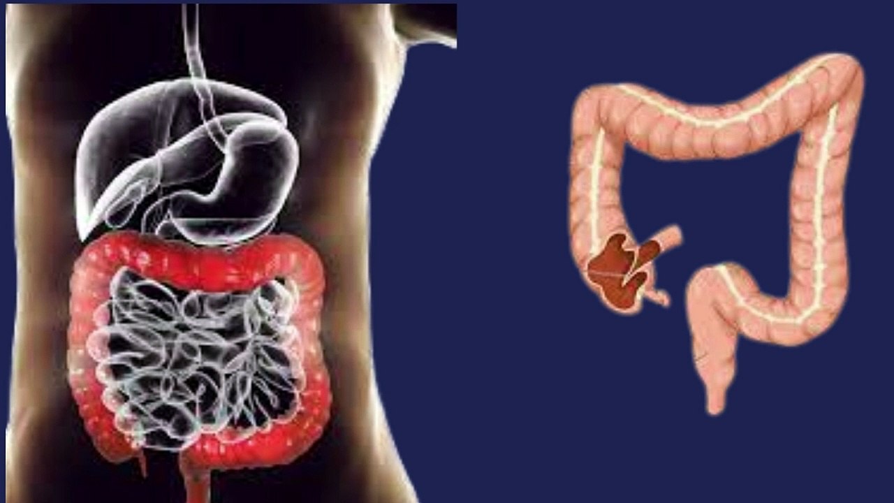 Health Nest /constipation?constipation causes treatment?قبض کیوں ھوتی ھے اور قبض کا علاج کیا ھے؟