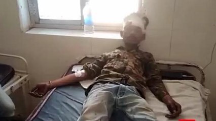 सीधी: युवक के साथ हुई जमकर मारपीट, अस्पताल में किया भर्ती