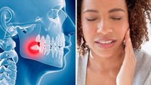 Home remedies to get rid of wisdom tooth pain in urdu | aqal dhar ka ilaj@rahmancare