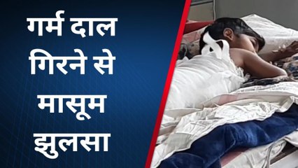 छतरपुर: दाल गिरने से मासूम झुलसा, परिजन आनन-फानन में लाए अस्पताल