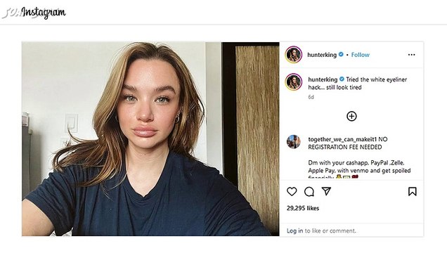 Young and the Restless- Hunter King Claps Back at Fans Over Plastic Surgery