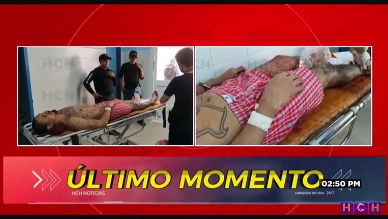 Llega al Hospital Gabriela Alvarado recluso herido en La Tolva