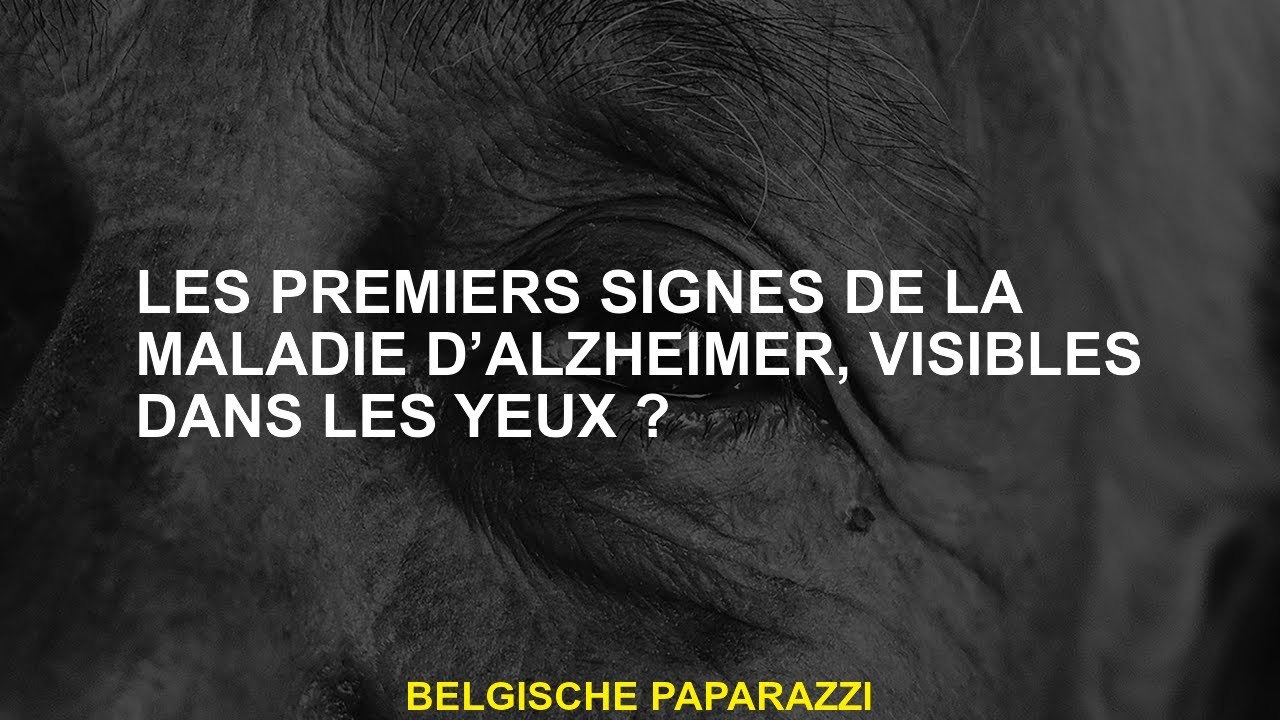 Les premiers signes de la maladie d’Alzheimer, visibles dans les yeux ...