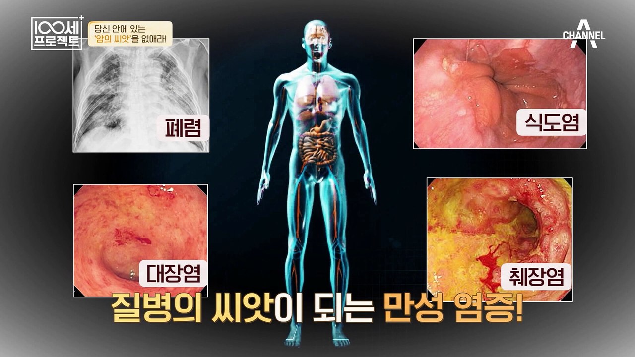 질병의 씨앗이 되는 "만성 염증"? 이를 없애는 물질, ▶글루타치온◀