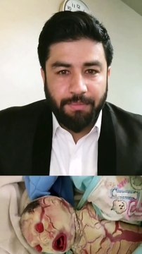 مظفر آباد میں عجیب و غریب دکھائی دینے والے بچے کی پیدائش حقیقت کیا ہے