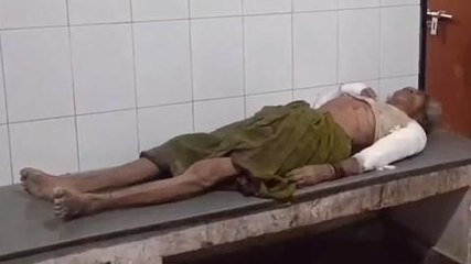 अम्बेडकरनगर: गाली देने से मना करने पर दबंगों ने वृद्धा पर बोला हमला, किया ये हाल