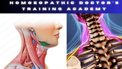 Cervical spondylosis homeopathic medicine