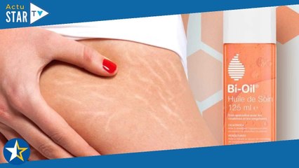 Réduction immanquable sur cette huile de soin pour les vergetures et cicatrices