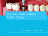 Recovering From Dental Implants Surgery 10 Life Hacks | Tide Dental & Orthodontics