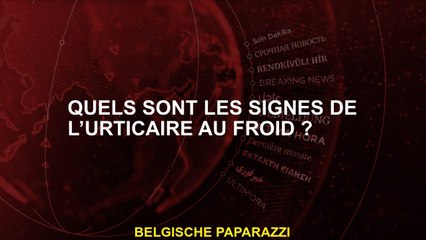 Quels sont les signes de l’urticaire au froid ?