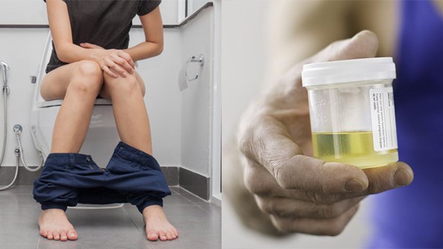 पेशाब में शुगर के लक्षण | पेशाब में शुगर का इलाज | Peshab Me Sugar Ke Lakshan | Boldsky