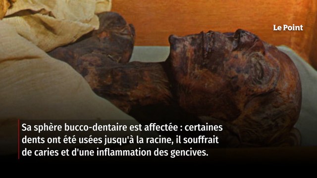 Ramsès II : ce que révèlent les secrets de sa momie