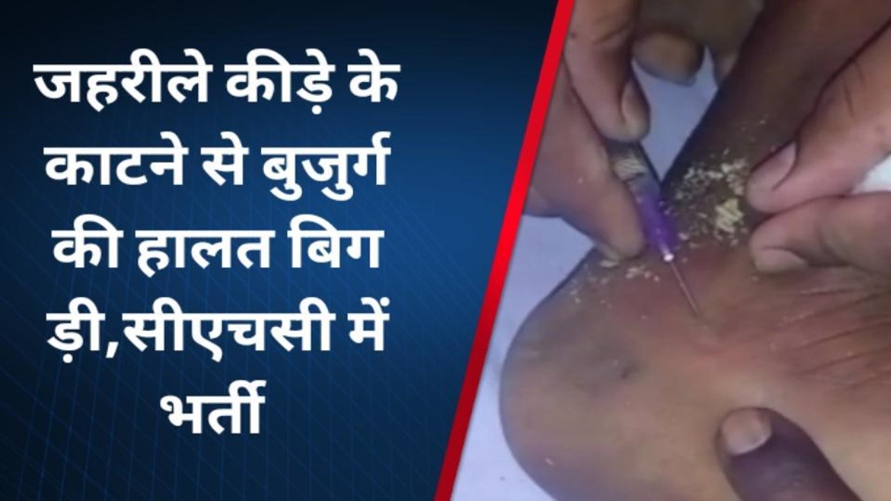 चित्रकूट: रहस्यमय कीड़े ने वृद्ध को बनाया अपना निशाना,आप भी इस कीड़े से रहे सतर्क
