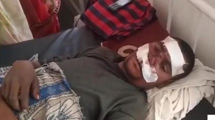 सीधी: तेज रफ्तार बाइक चलना युवक को पड़ा महंगा, युवक हुआ घायल