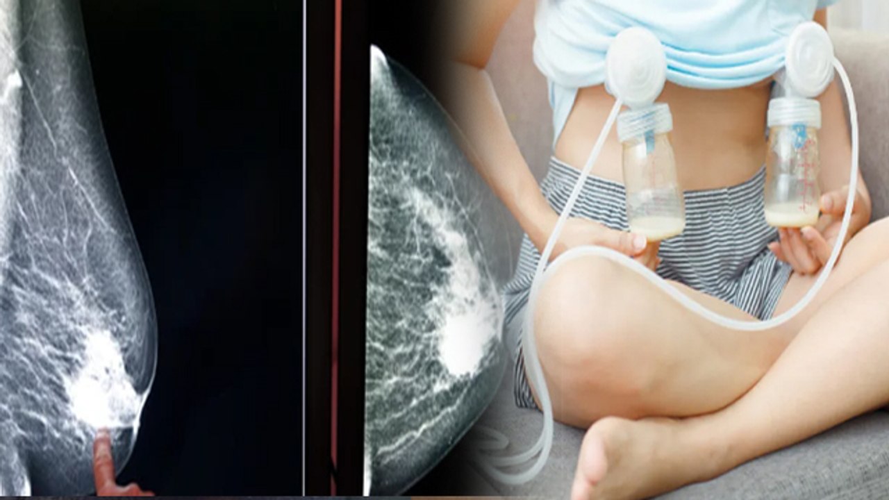 Breastfeeding Pump Side Effects | Breast Milk Pump Side Effects | ब्रेस्ट फीडिंग पंप के नुकसान