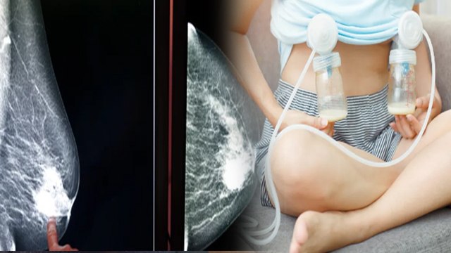Breastfeeding Pump Side Effects | Breast Milk Pump Side Effects | ब्रेस्ट फीडिंग पंप के नुकसान