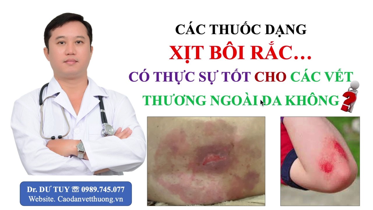 Các thuốc dạng xịt, bôi, rắc có thực sự tốt cho các vết thương ngoài da không? Thuốc điều trị ngoài da