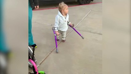 Five-year-old girl born with "mermaid syndrome" has taken her first steps after surgery