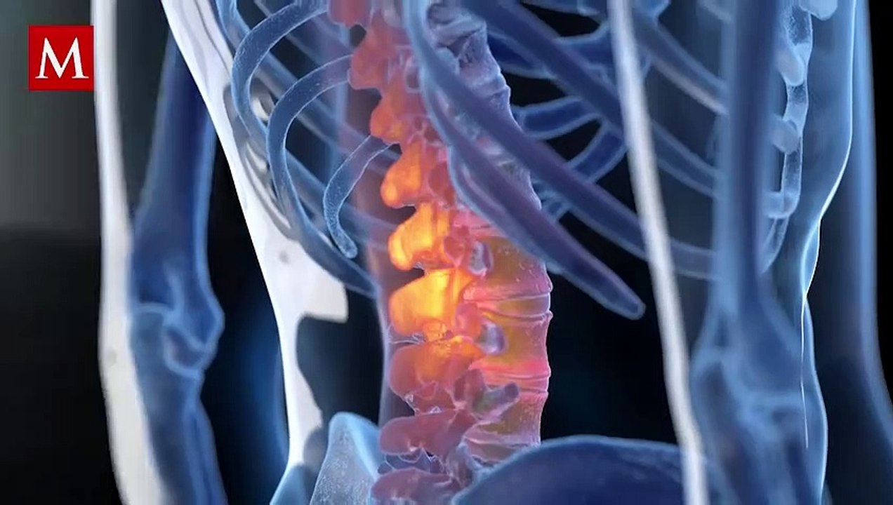 Hombre queda paralítico después de sonarse la nariz y desmayarse: "Todo se detuvo por completo"