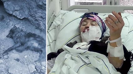 Yüzünü ısıran kurt kuduz çıkmıştı! Yaşadığı dehşeti ilk kez anlattı