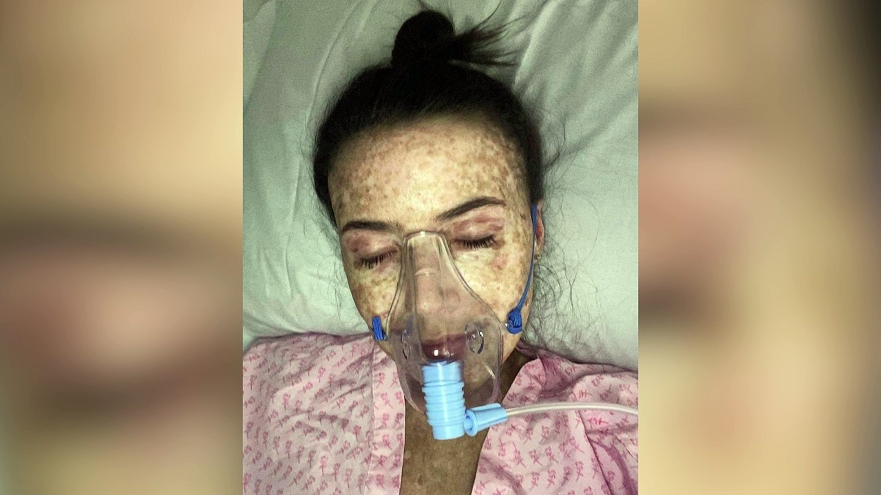 Woman who was told she had tonsillitis correctly diagnosed herself with leukaemia - using GOOGLE