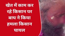 लखीमपुर खीरी: खेत में काम कर रहे किसान पर बाघ ने किया हमला,हुआ घायल अस्पताल में भर्ती