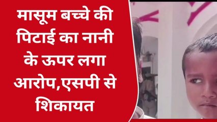 प्रतापगढ़: मासूम बच्चे को नानी ने बेरहमी से पीटा, आँख फोड़ने का प्रयास