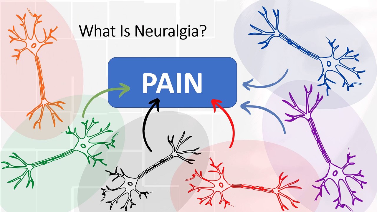 What is neuralgia? Symptoms, causes and treatment of the disease