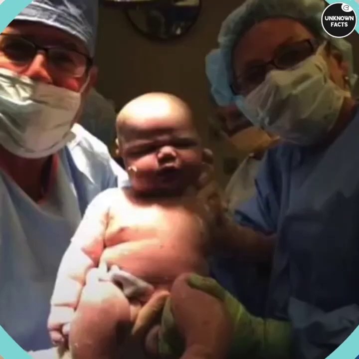 Mom Gives Birth To A Baby That Turned Out To Be The Same Size As A Toddler