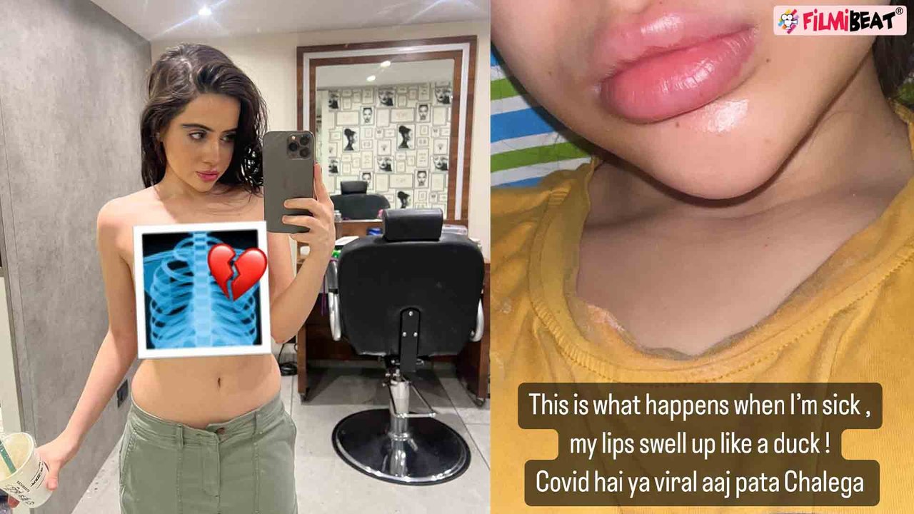 Urfi Javed के Lips सूजन से बने ऐसे, तबीयत खराब में भी किया ऐसा Post, Photos  हुई Viral! FilmiBeat