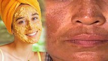 Moong Dal और Milk Face Pack लगाने से क्या होता है, Tanning से लेकर Wrinkles में फायदेमंद । Boldsky