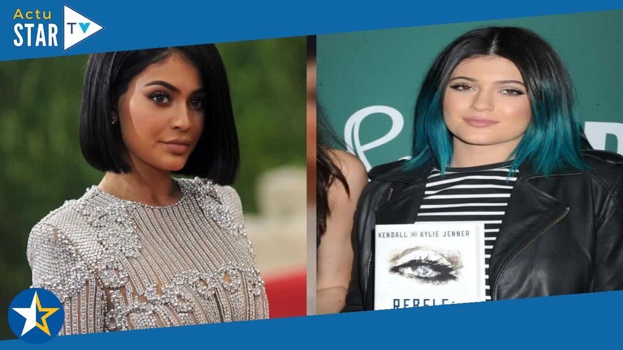 Kylie Jenner : combien a coûté sa transformation physique ?