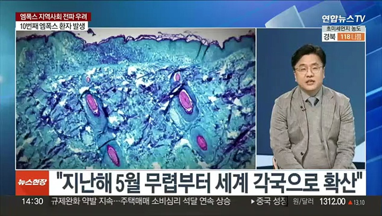 [이슈+] 해외여행력 없는 엠폭스 환자 증가…지역사회 전파 우려