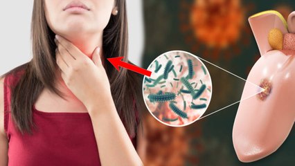 गर्मी में गला सूखना Tonsillitis Symptoms, कैसे करें Treatment | Boldsky