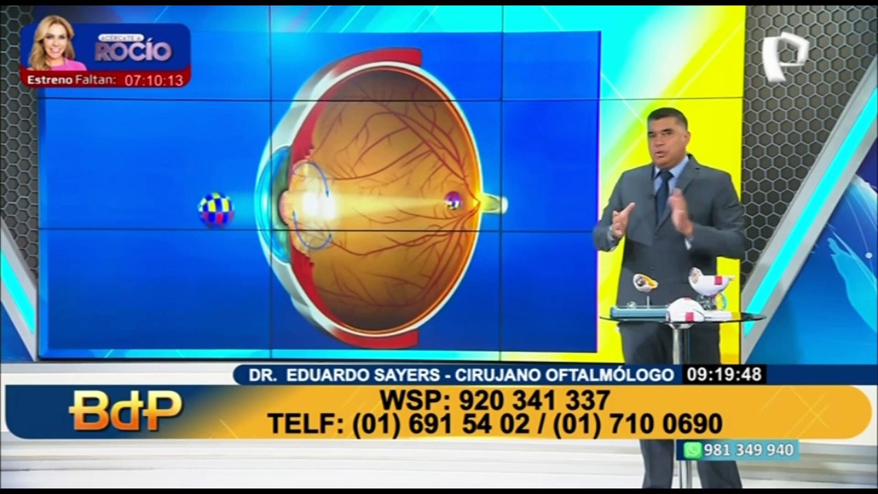 ¿Qué hacer para tratar las cataratas? Dr. Eduardo Sayers nos brinda algunas recomendaciones