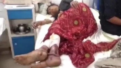 पन्ना: मां-बेटे पर कुल्हाड़ी व पेचकस से जानलेवा हमला, देखे दर्दनाक मामला